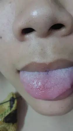 175796