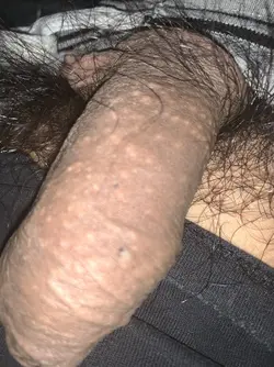 186072