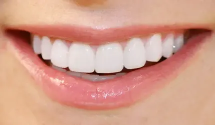 boc-rang-su-dinh-nghia.webp