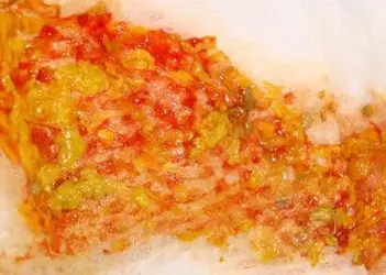 phân đổ.webp