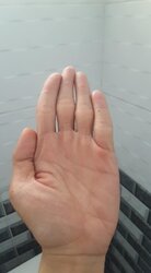 396652
