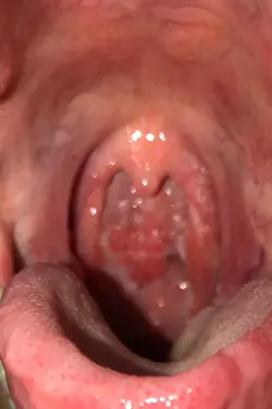 8391 8391