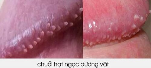 hat-ngoc-duong-vat.jpg