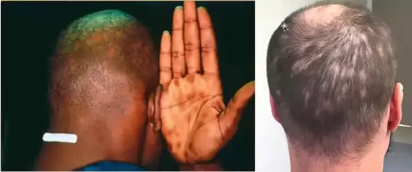 99494 99494