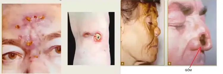 99496 99496