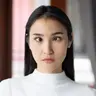 Mắt lác